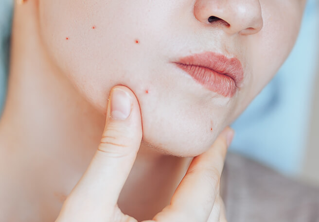 Frau prüft Hautbild