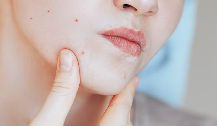 Frau prüft Hautbild